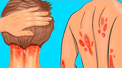10 Warning Signs You Have Vitamin D Deficiency