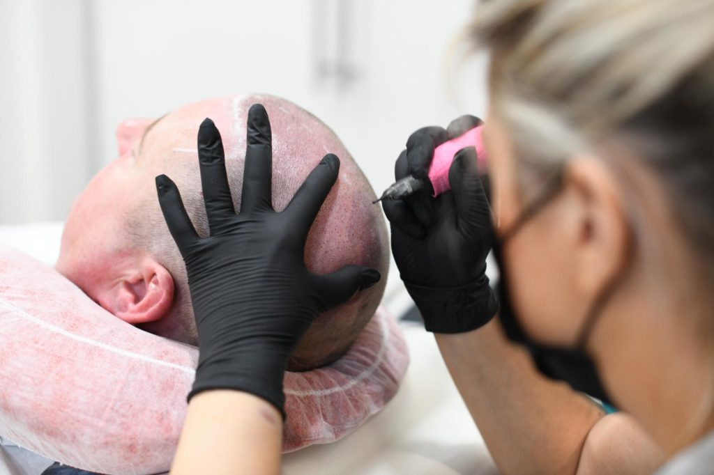 Scalp Micropigmentation Masterclass