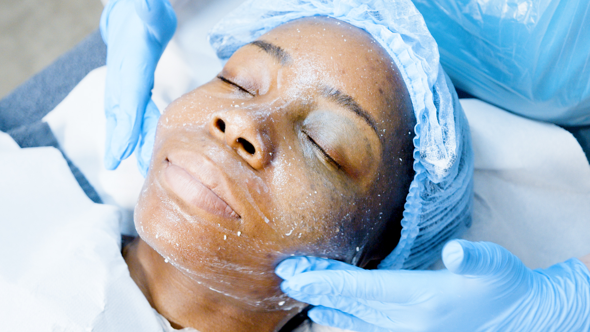 Online Chemical Skin Peels training course