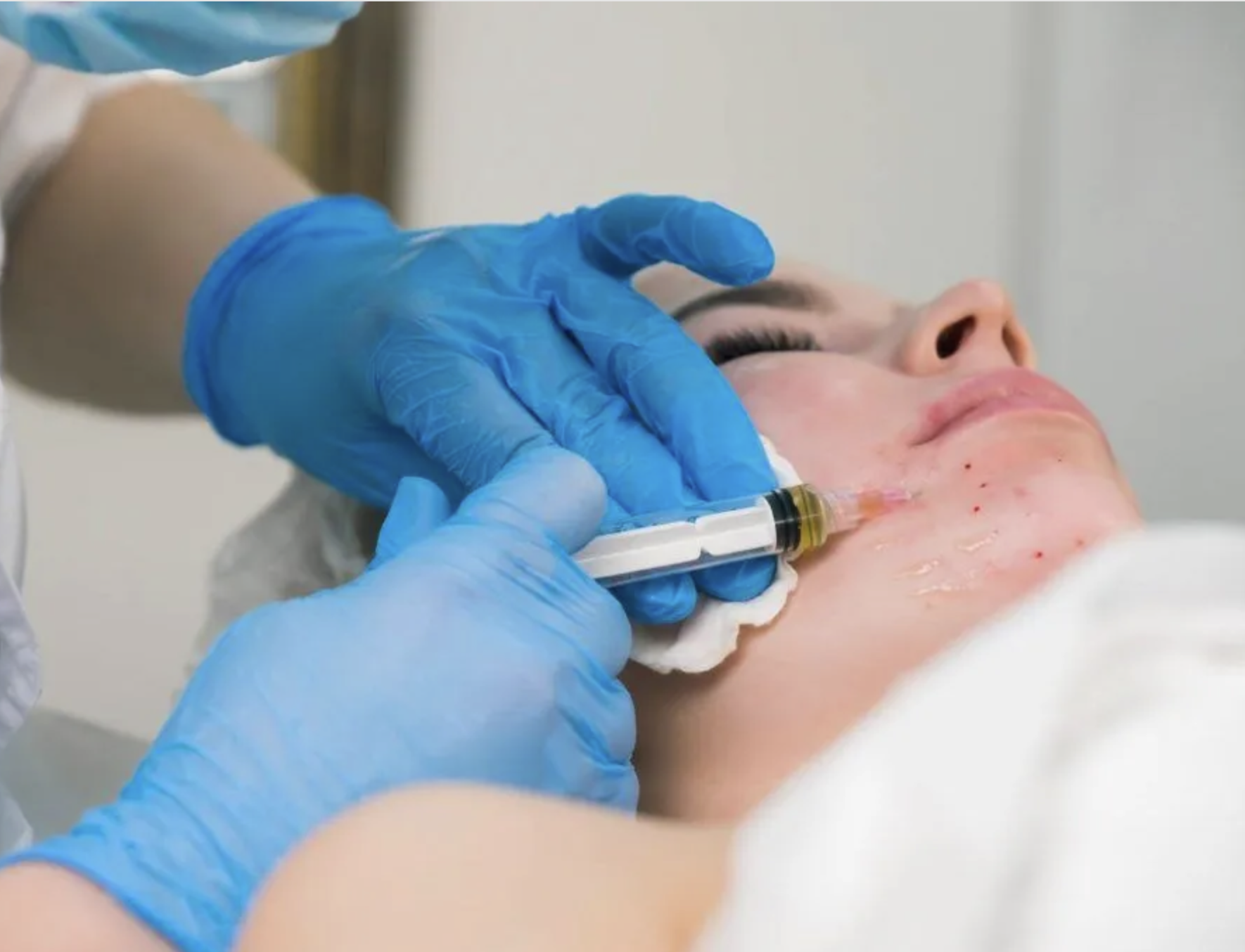 Platelet Rich Plasma (PRP) Training