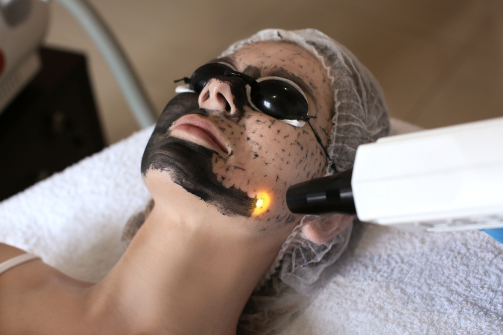 Carbon Laser Facial Training