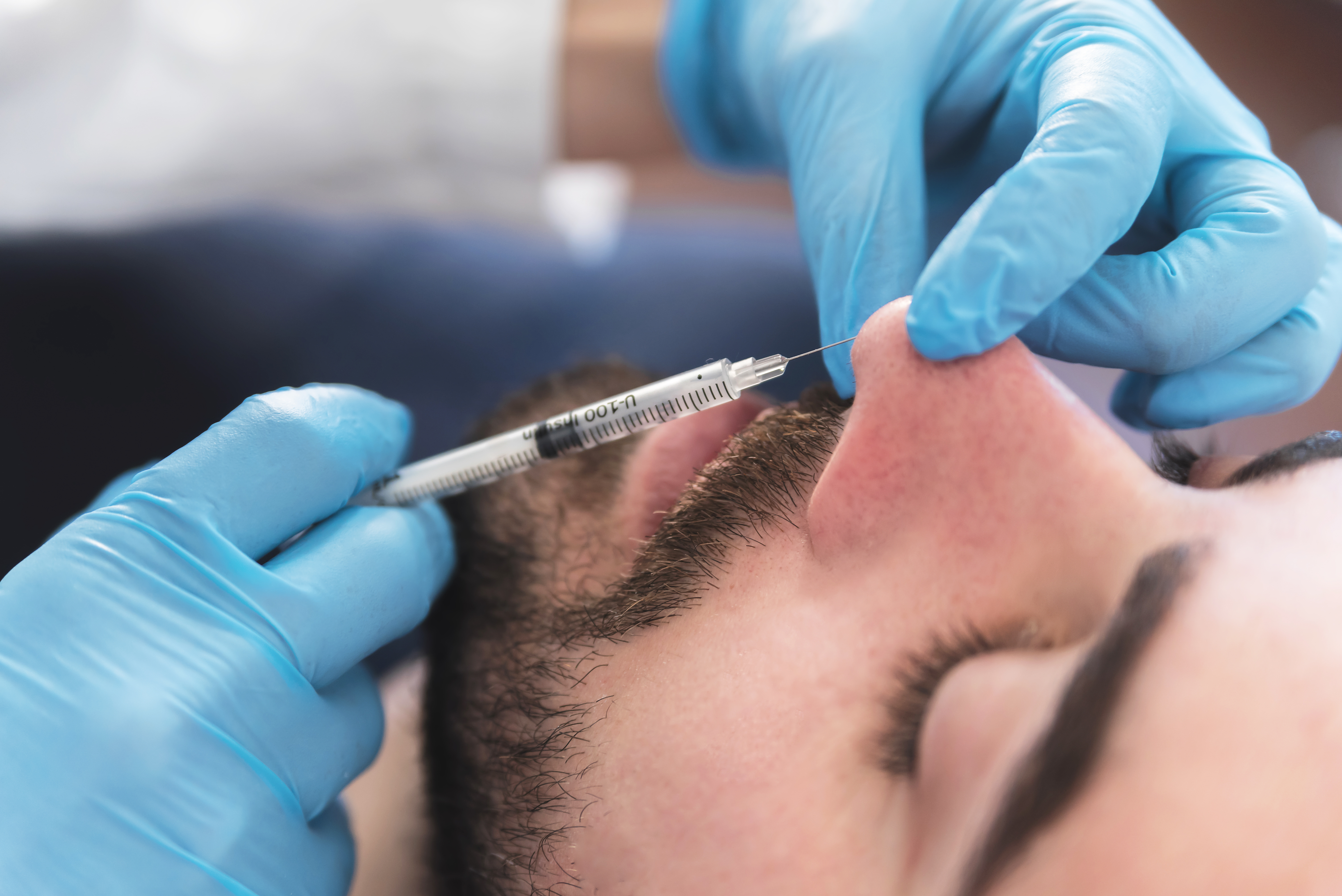 Dermal Filler Non-Surgical Rhinoplasty