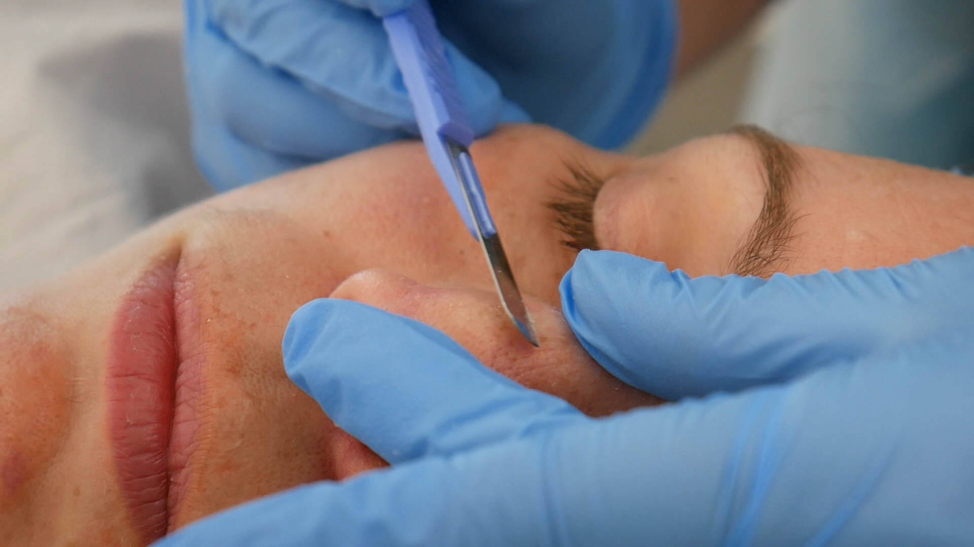 Online Dermaplaning training course