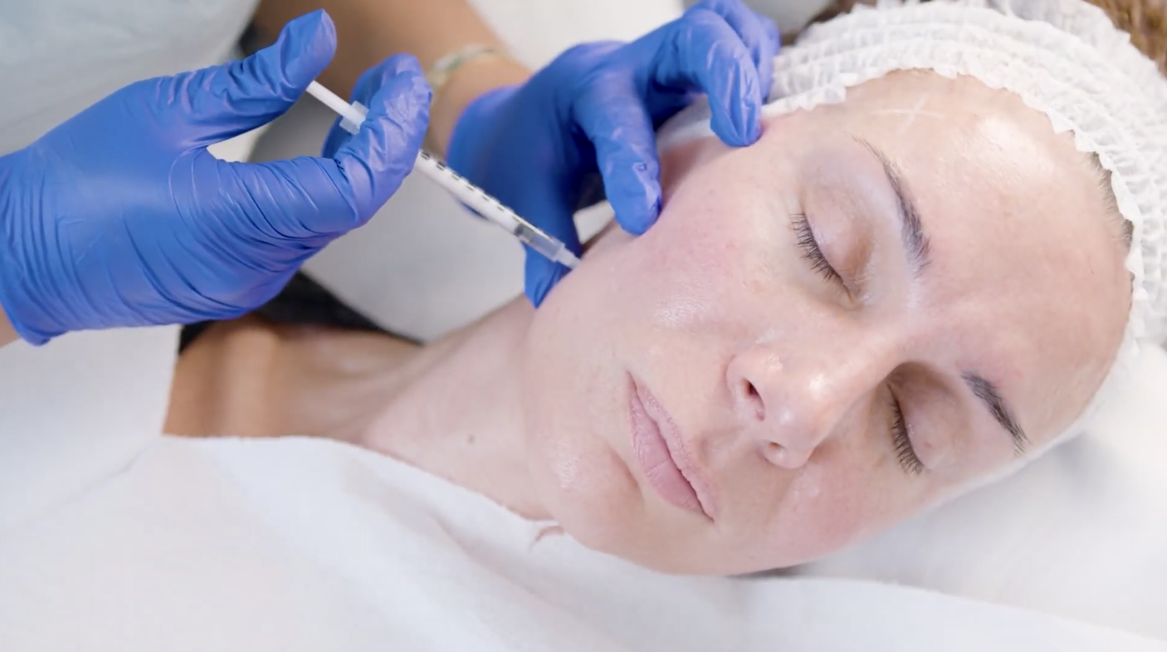 Anti-wrinkle model treatment