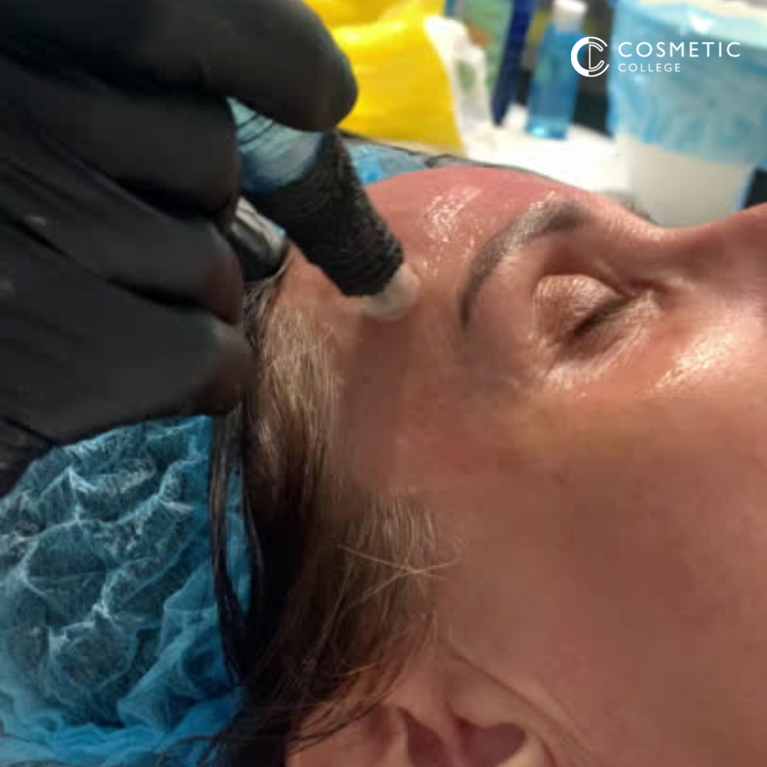 Online Microneedling training course