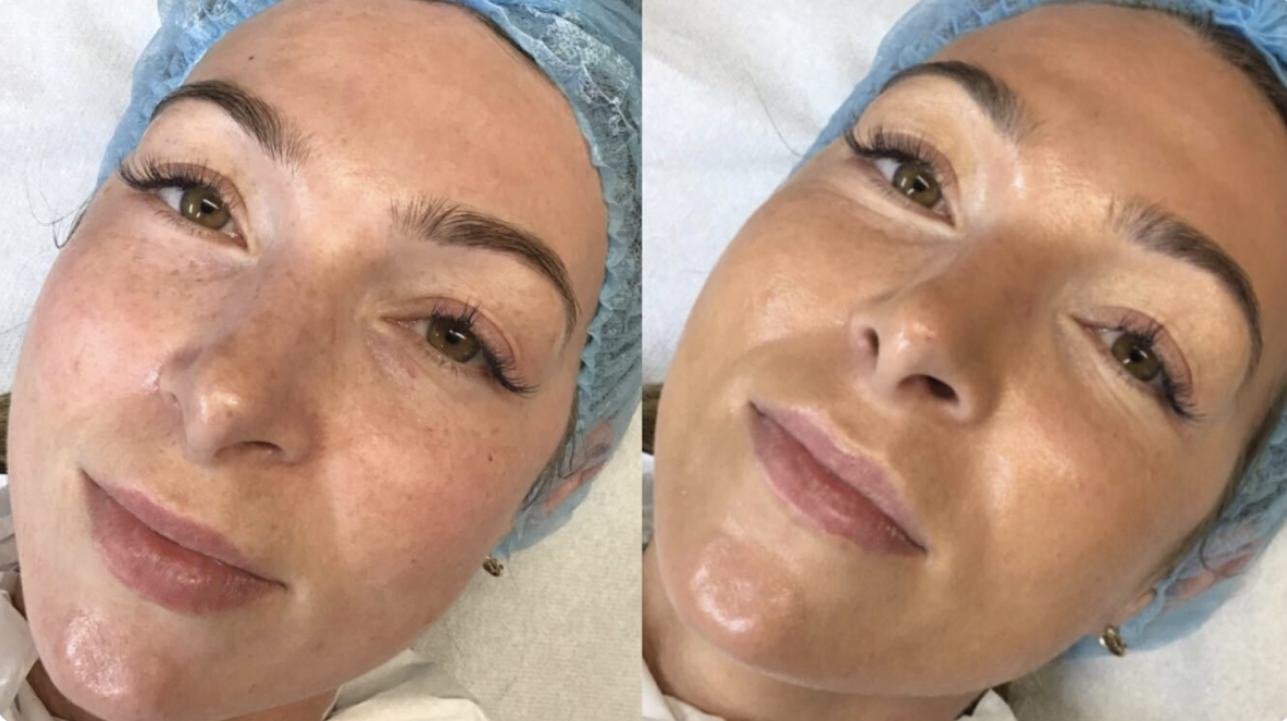 Online BB Glow Foundation training course