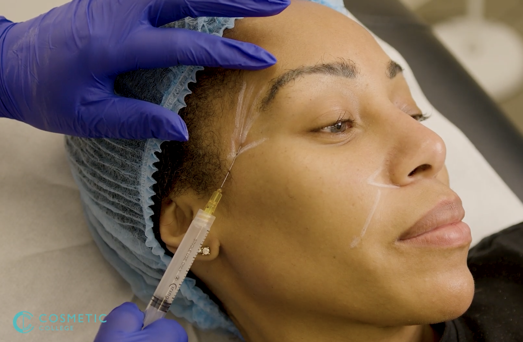 Online Bio Stimulators (Sculptra & Aesplla) training course