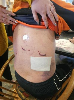 Neil crayston injuries