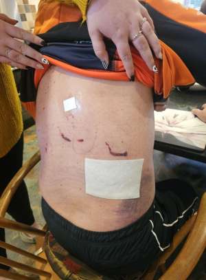 Neil crayston injuries