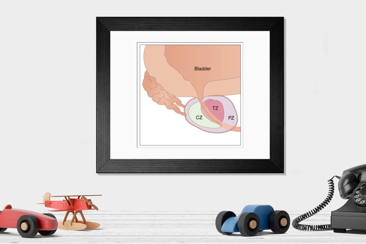 Shown hanging in a room: Modern 14"x12" (36x31cm)