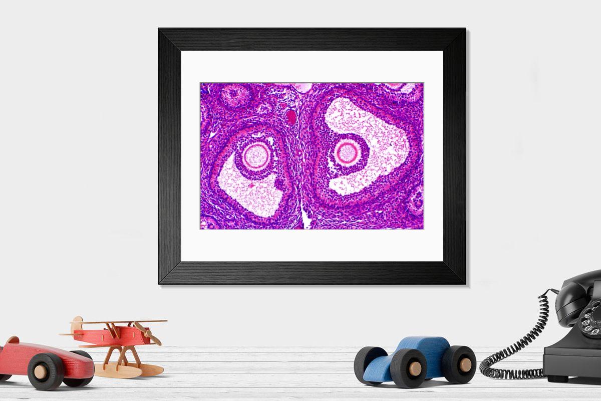 Shown hanging in a room: Modern 14"x12" (36x31cm)
