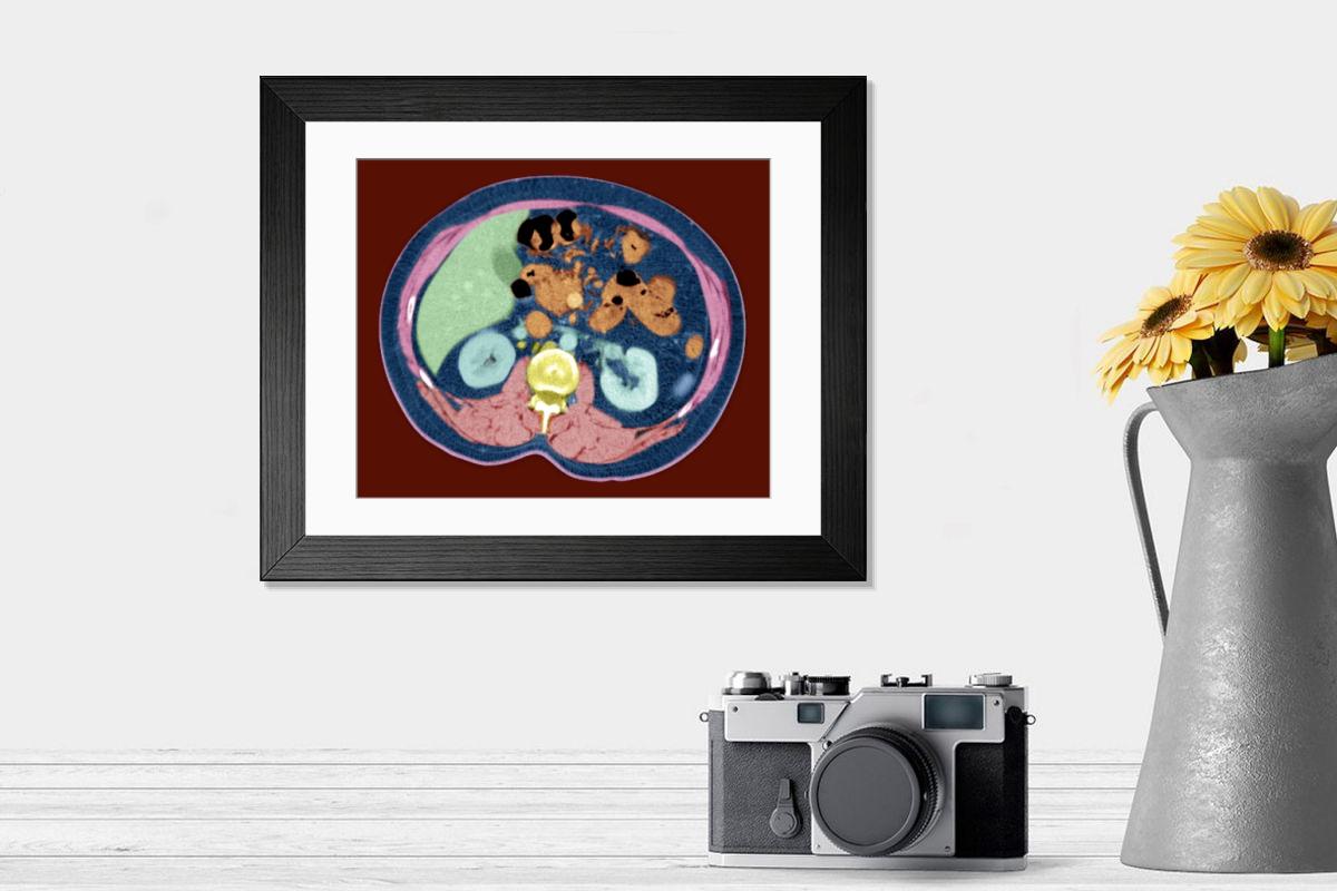 Shown hanging in a room: Modern 14"x12" (36x31cm)