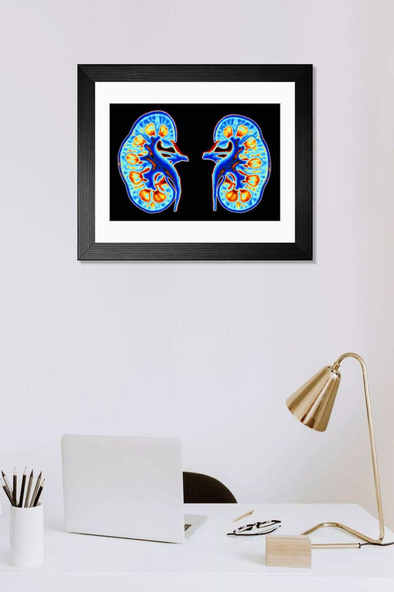 Shown hanging in a room: Modern 14"x12" (36x31cm)