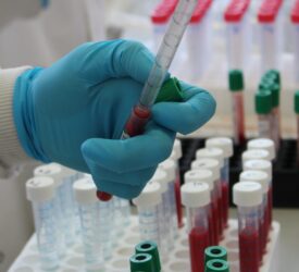 NFU welcomes voluntary blood testing for TB