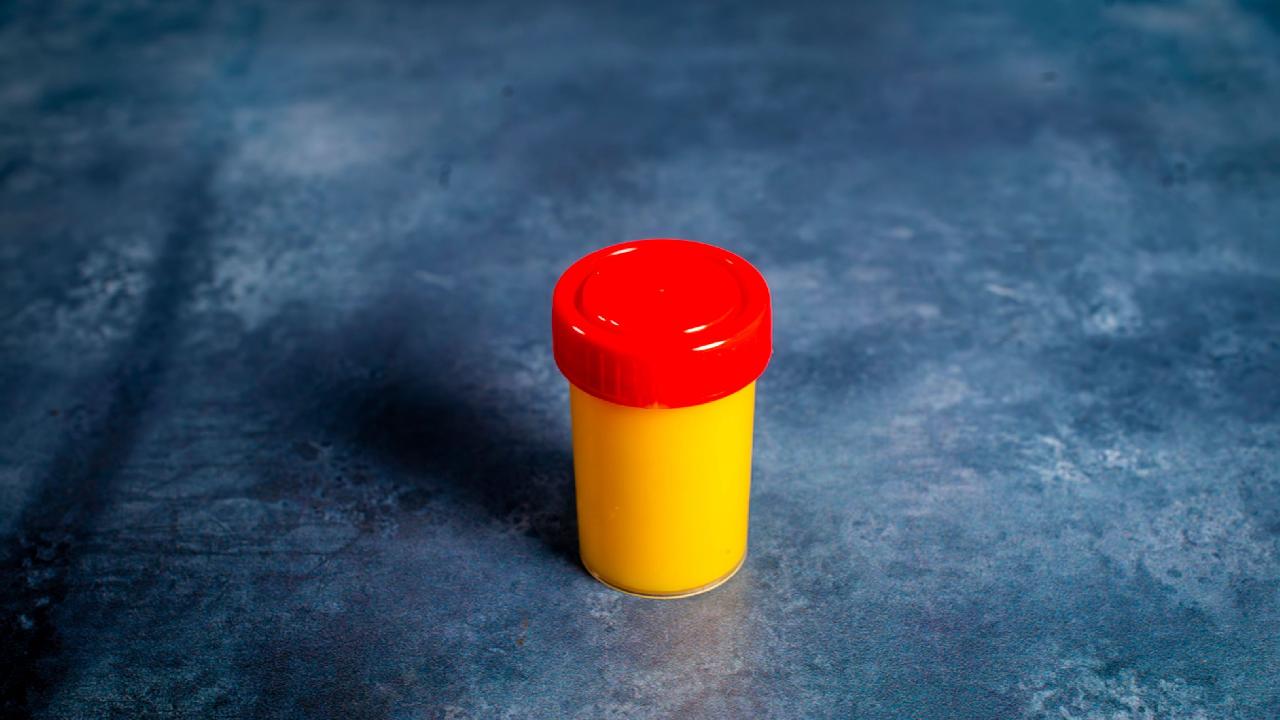 Meal card cover for: Ginger Turmeric Lemon Shot