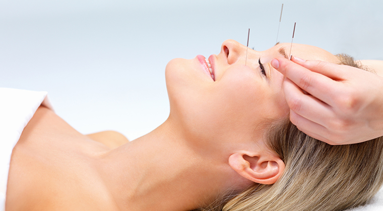 Acupuncture facial rejuvenation