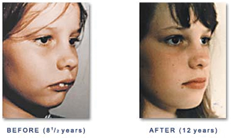 Breathe through the nose