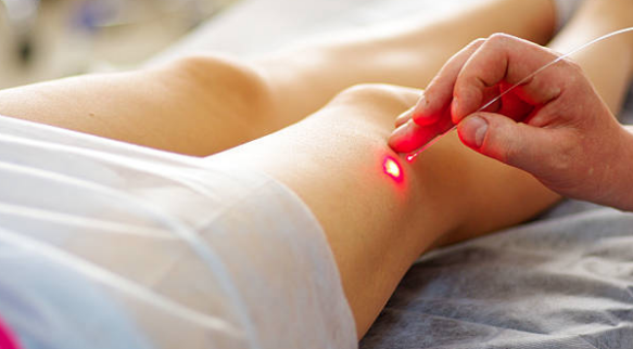 Cosmetic Revolution With Laser Treatment: Know More