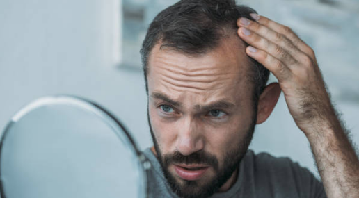 Life After Rogaine: What Happens Next