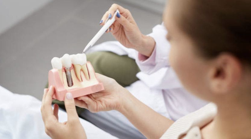 Build Your Confidence Up With Dental Implants: What to Expect