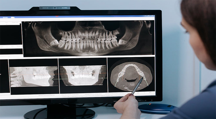 Intraoral Tomosynthesis: Precision in Dentistry