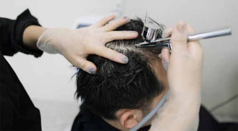 Unlocking Confidence: Male Hair Restoration Solutions