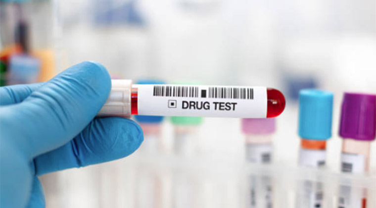 The Relationship Between Mental Health and Drug Test Compliance