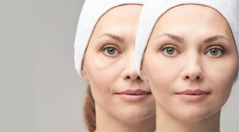 7 Rejuvenation Treatments That Can Make You Look Radiant