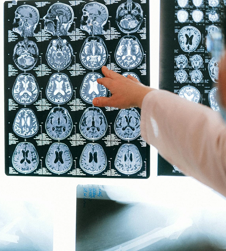 Exploring the Legal Rights of Brain Injury Survivors
