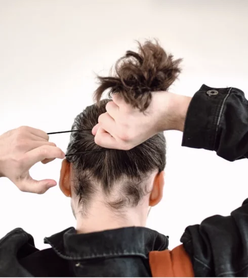 hair loss
