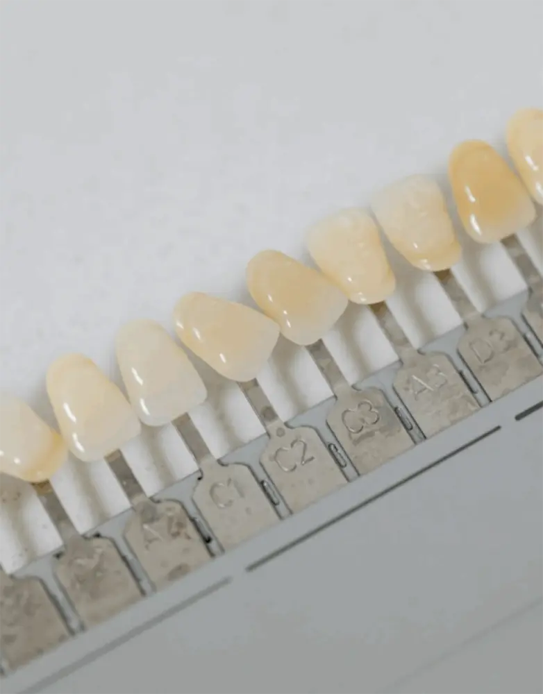All on 4 Dental Implants a Complete Guide for Atlanta GA Patients