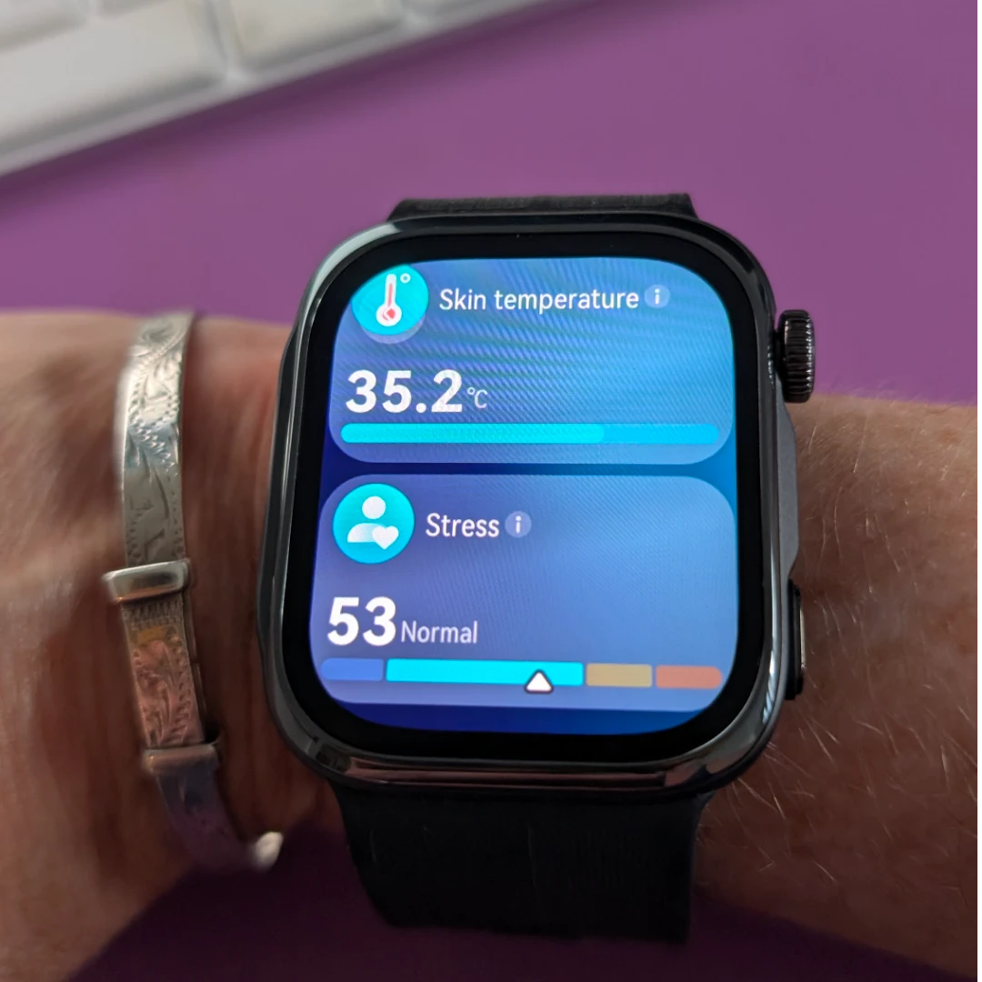 A watch with an inflatable cuff