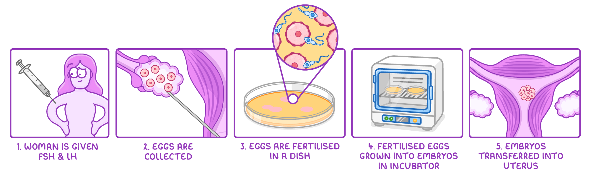 Five numbered panels showing IVF: a woman given FSH and LH by injection, eggs collected from an ovary, eggs fertilised in a dish, embryos grown in an incubator, and embryos transferred into the uterus.