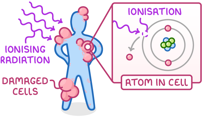 A figure covered in pink lumps labelled damaged cells with wavy arrows labelled ionising radiation striking it, and an inset labelled atom in cell showing an electron knocked out of its shell, labelled ionisation.