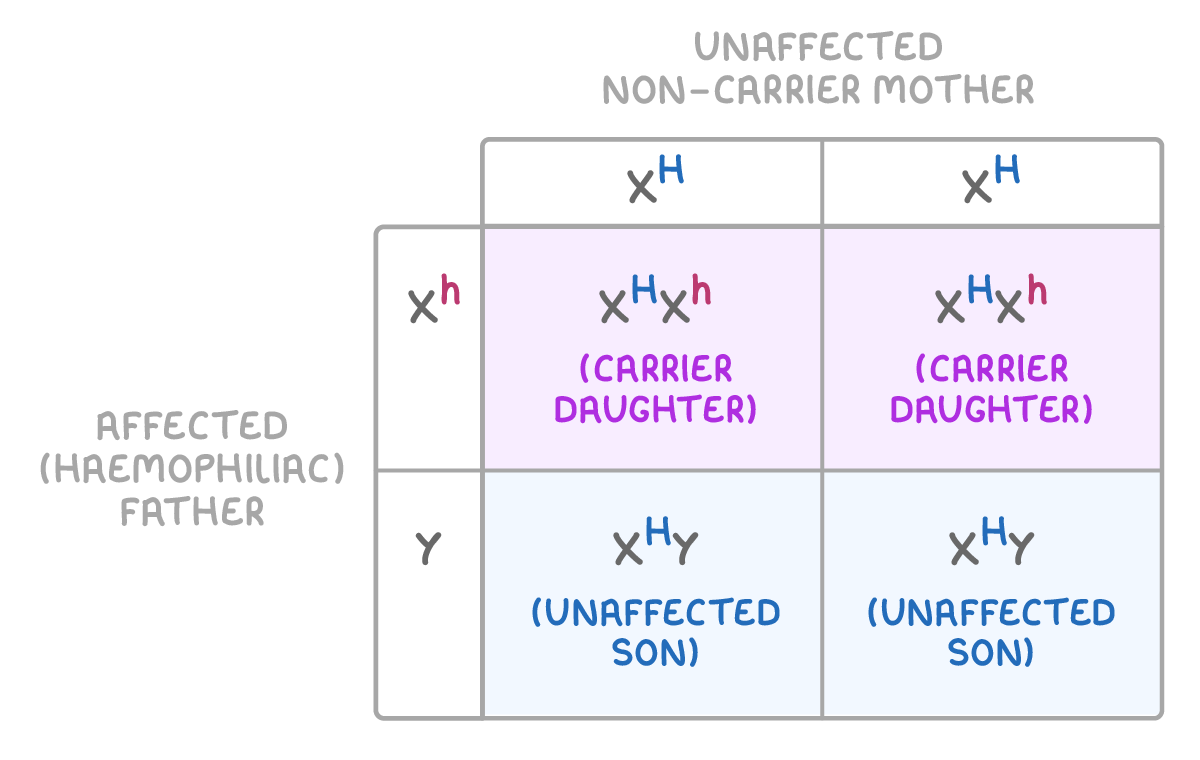 Punnett square with the unaffected non-carrier mother's two X^H across the top and the affected haemophiliac father's X^h and Y down the side, all four cells labelled carrier daughter or unaffected son.