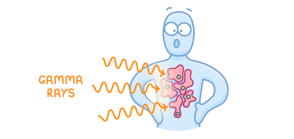 Three orange wavy arrows labelled gamma rays travel from the left into a person's torso, where they converge on a cluster of pink tumour cells inside the body.
