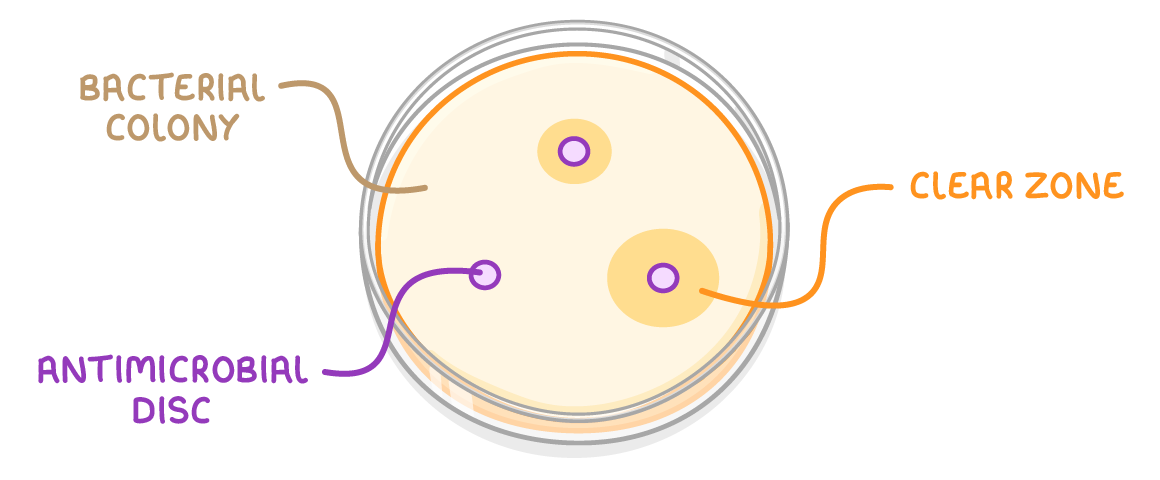 A round petri dish seen face on, its cream surface labelled bacterial colony, with two small purple discs labelled antimicrobial disc, each ringed by a yellow halo labelled clear zone.
