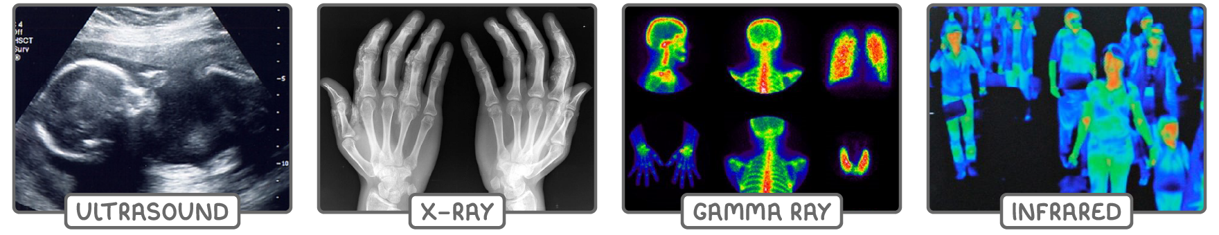 Four medical scan photographs side by side, labelled ultrasound showing a foetus, x-ray showing two hands, gamma ray showing colourful head, chest and skeleton scans, and infrared showing a crowd of people.