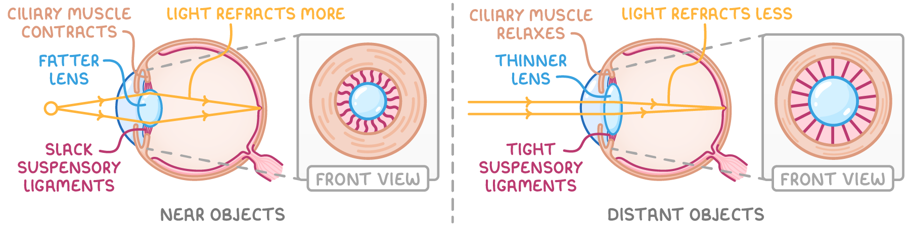 Two side-view eyes with rays focusing on the retina, one labelled near objects, ciliary muscle contracts, fatter lens, slack suspensory ligaments, the other distant objects, thinner lens, tight suspensory ligaments.