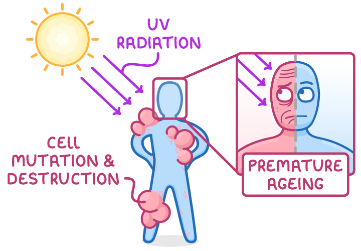 The Sun sends purple arrows of UV onto a blue figure covered in pink lumps, labelled UV radiation and cell mutation & destruction, beside a close-up of a half-wrinkled face labelled premature aging.