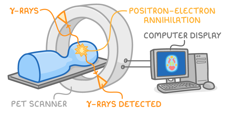 A patient on a bed inside a ring labelled PET scanner, with a burst labelled positron-electron annihilation sending gamma-rays to detectors labelled gamma-rays detected, wired to a computer display showing a colour brain image.
