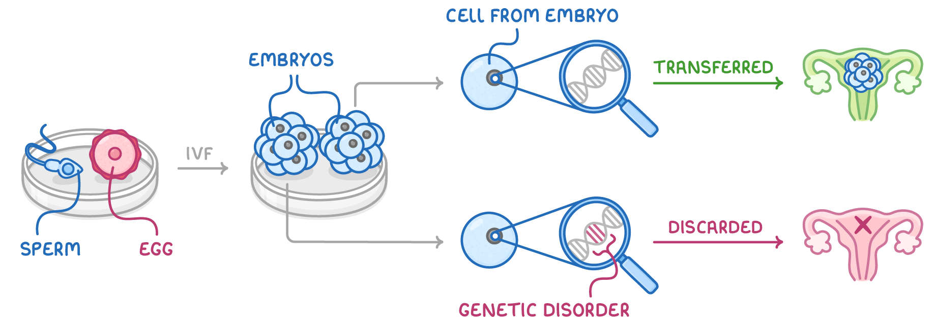 Sperm and egg in a dish, an arrow labelled IVF leading to embryos, then one cell from embryo examined under a magnifier: healthy DNA transferred to a uterus, DNA with a genetic disorder discarded.