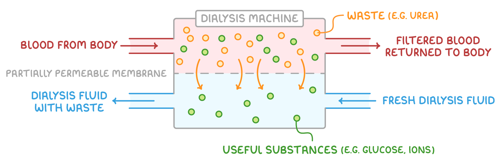 Blood flows along the top of a labelled dialysis machine and dialysis fluid along the bottom, separated by a partially permeable membrane, with arrows carrying waste such as urea down into the fluid.
