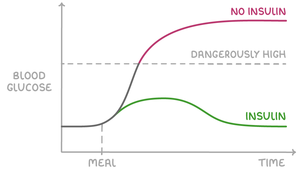 A graph of blood glucose against time that splits at meal into a pink no insulin curve rising above a dashed dangerously high line and a green insulin curve rising slightly then falling back.