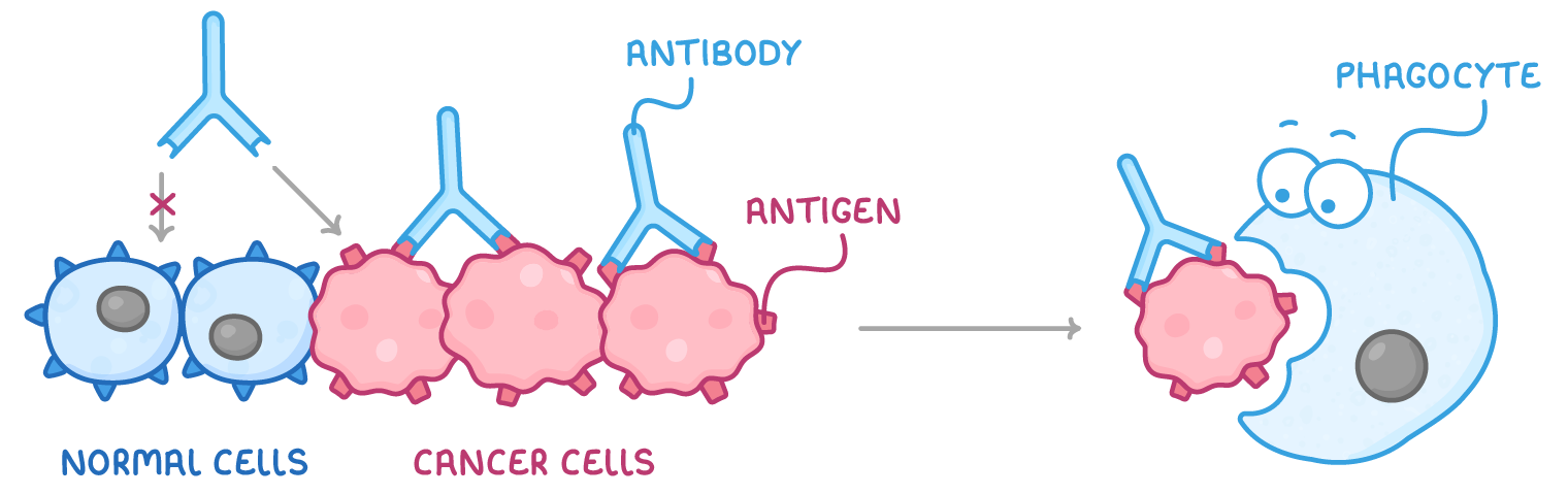 An antibody is crossed out above two normal cells but binds antigens on three cancer cells, and an arrow leads to a phagocyte engulfing one; labels read antibody, antigen, normal cells, cancer cells, phagocyte.