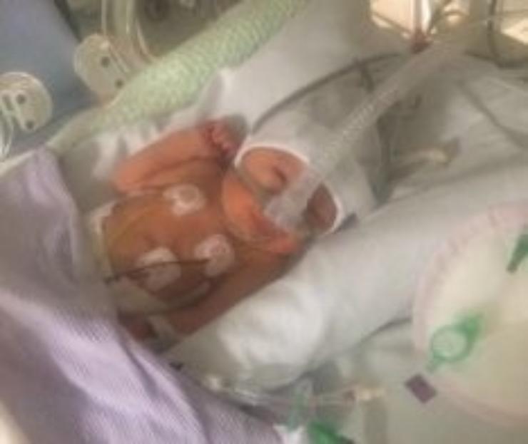 cpap premature baby