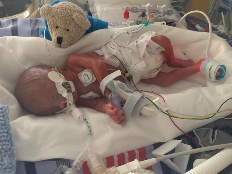24 Weeks And 780 Grams Olivia S Story Bliss