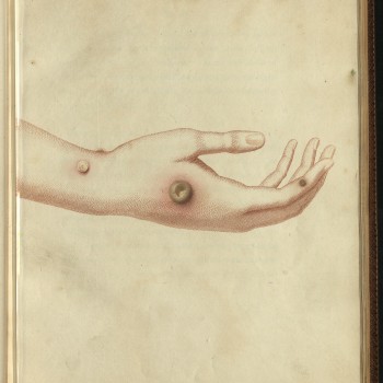 Renaissance and Early Modern Medicine