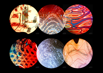 Mitosis