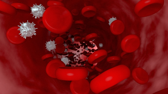 Medical visualization